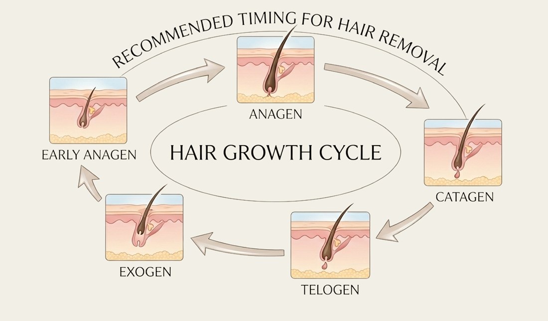 Hair growth cycle — early anagen, anagen (recommended timing for hair removal), catagen, telogen, exogen