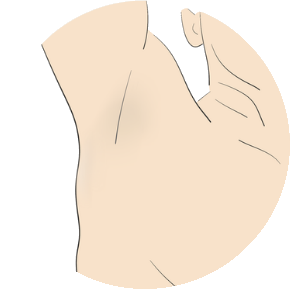 Underarms